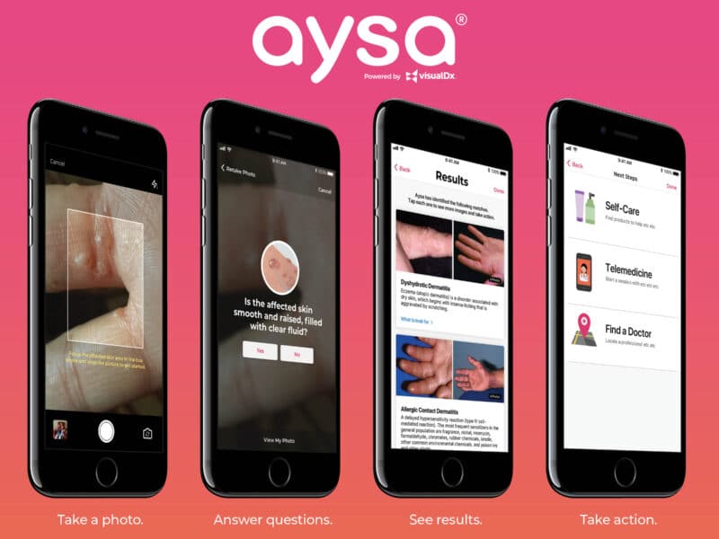 Personalized Answers to your Skin Problems. Take a Picture. Ask Aysa.