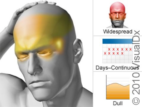 Chronic tension headaches involve mild to moderate head discomfort, generally on both sides of the head. A chronic tension headache is present for 15 or more days of a month for at least 3 months.