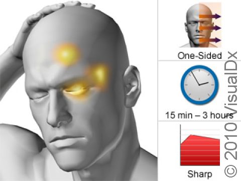 A cluster headache involves frequent attacks of severe, short-lasting, one-sided head pain, typically behind or near the eye, that can last from a few minutes to several hours.