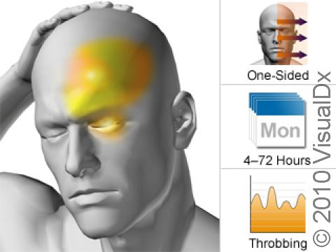 A common or classical migraine involves a sharp or throbbing headache on one side of the head. A migraine usually lasts from several hours to a few days and can be preceded by warning signs, such as flashes of light or a visual aura.