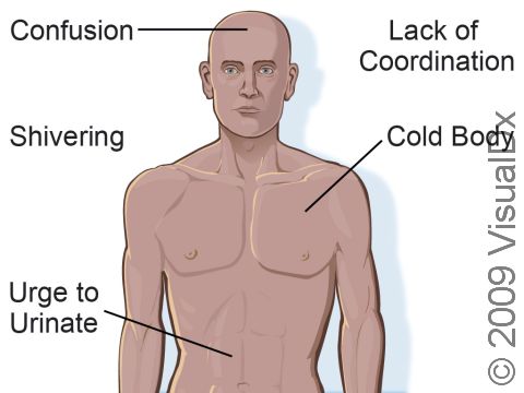 Mild hypothermia signs and symptoms can include shivering, confusion, cold body, urge to urinate, and/or lack of coordination.