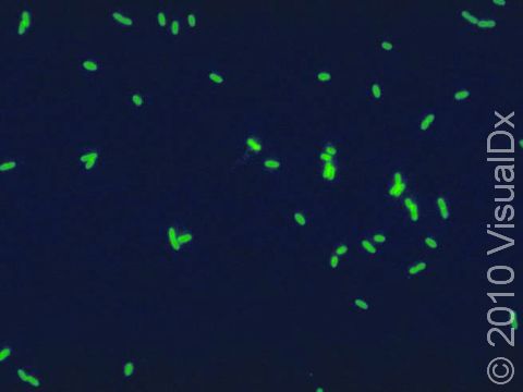 The Legionella pneumophila bacteria are tagged with a monoclonal antibody treated with a fluorescein dye. After binding to the bacteria the slide is viewed under ultraviolet light, and the bacterial cell walls glow green.