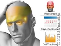 Medication Overuse Headache – Atlas