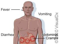 Salmonellosis – Atlas