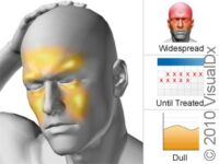 Sinus Headache – Atlas